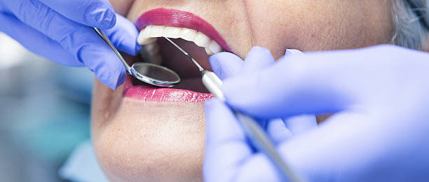 Best Dentist for Dental Trauma  in Windermere, FL